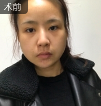 超级微拉美