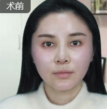 超级微拉美