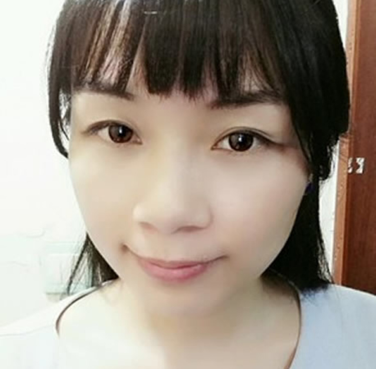 超声波祛眼袋