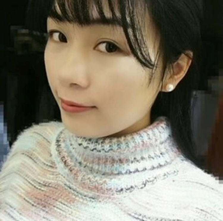 超声波祛眼袋