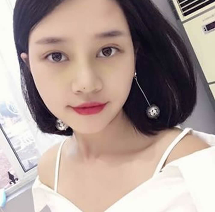 超声波双眼皮