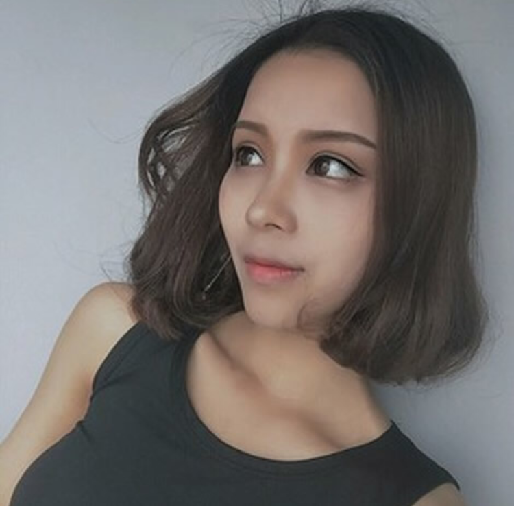 超声波双眼皮