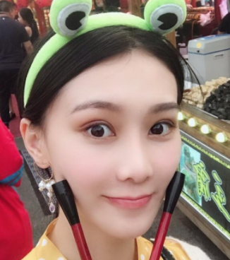 双眼皮手术