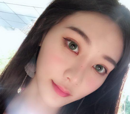 双眼皮手术