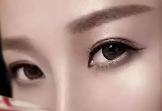 双眼皮手术