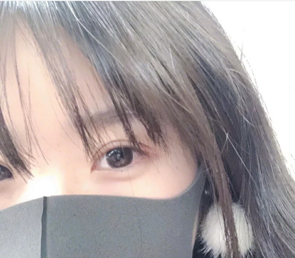超声波双眼皮