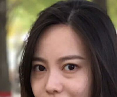 超声波按摩去眼袋