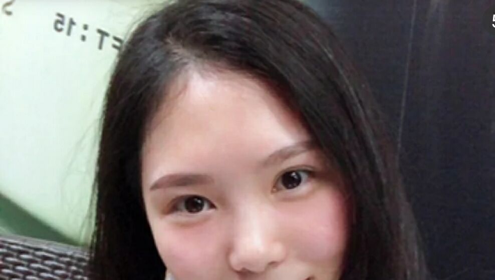 超声波按摩去眼袋