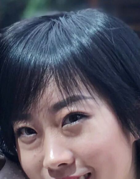 超声波去眼袋