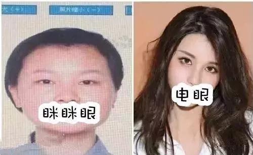 双眼皮手术