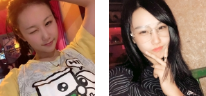 双眼皮手术