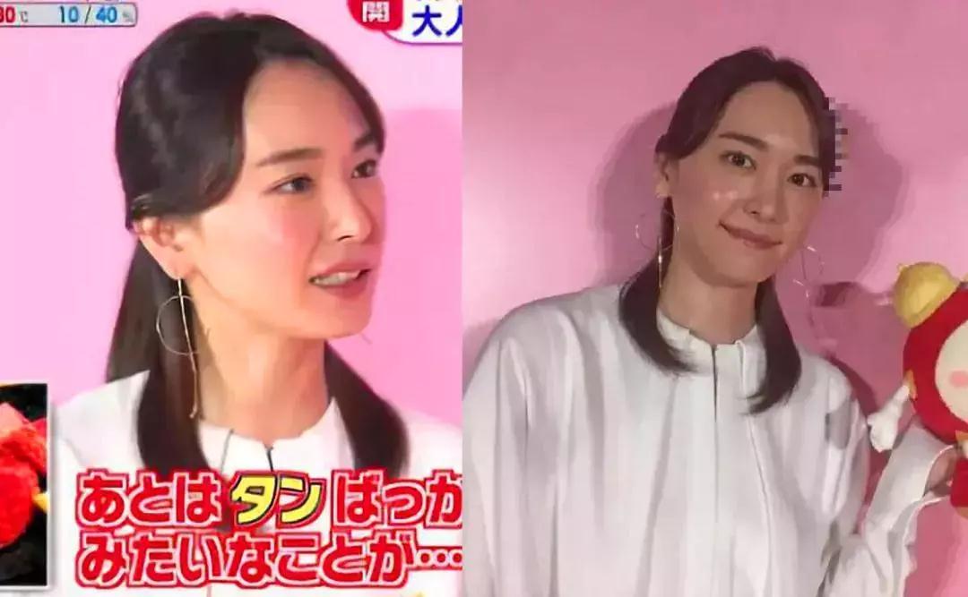 双眼皮手术