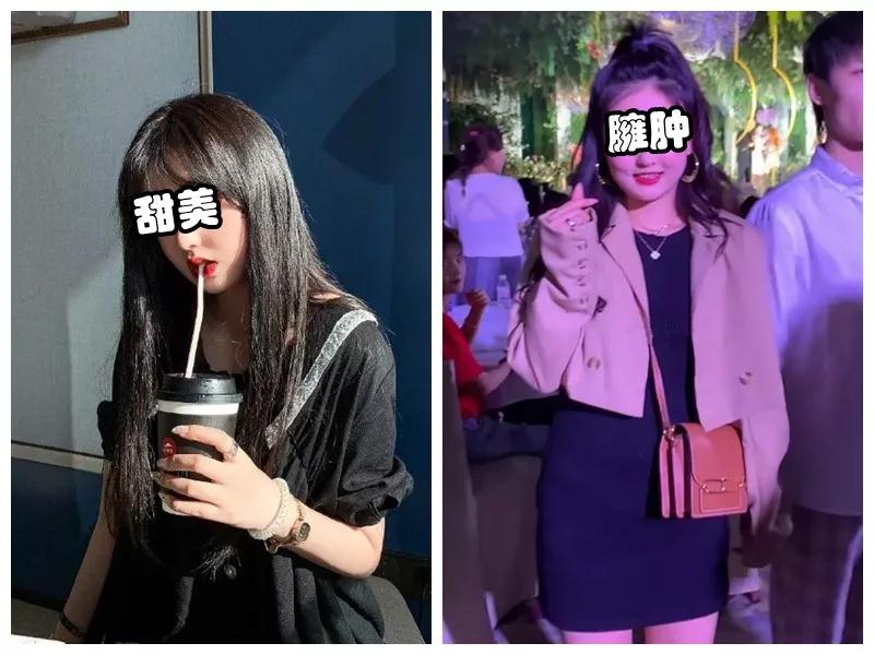 吸脂减肥