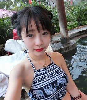 双眼皮手术