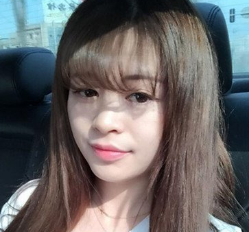 双眼皮手术