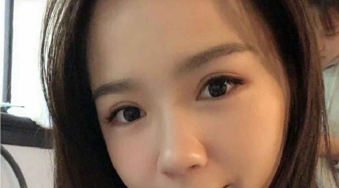 超声波按摩双眼皮