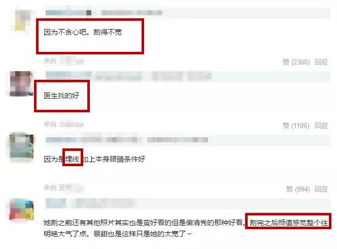 双眼皮手术