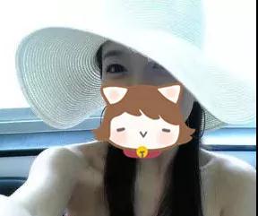 双眼皮手术