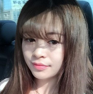 双眼皮手术