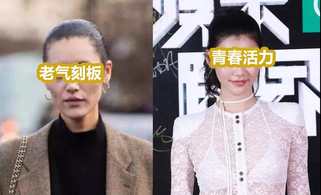 自体脂肪面部填充术