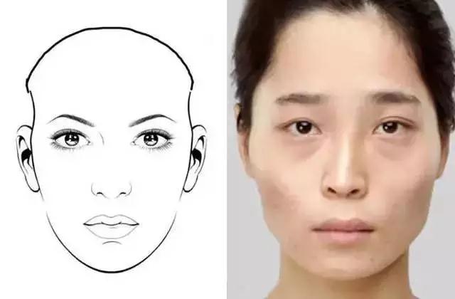 自体脂肪面部填充术