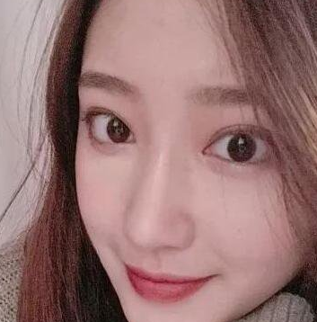 隆鼻手术