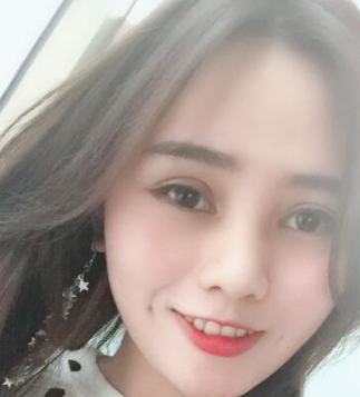 双眼皮手术