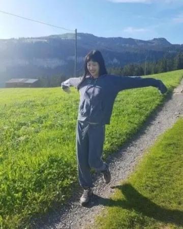 双眼皮手术