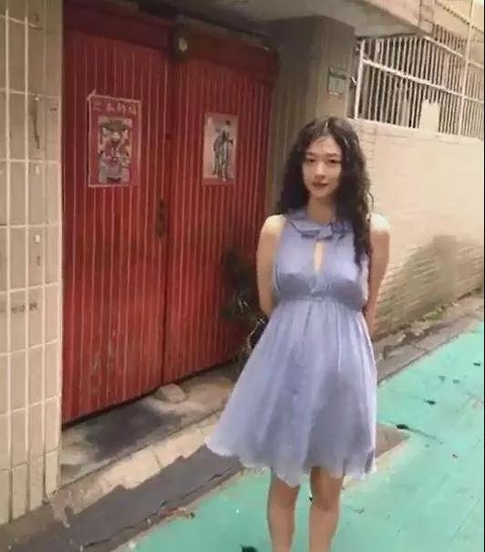 双眼皮手术