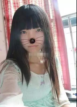 双眼皮手术