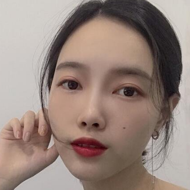 自体脂肪填充术