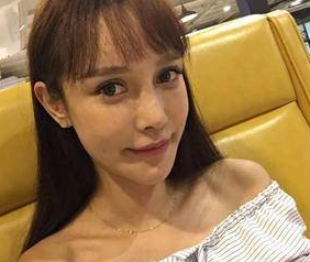 自体脂肪填充术