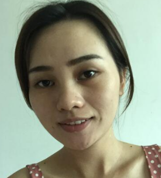 双眼皮手术