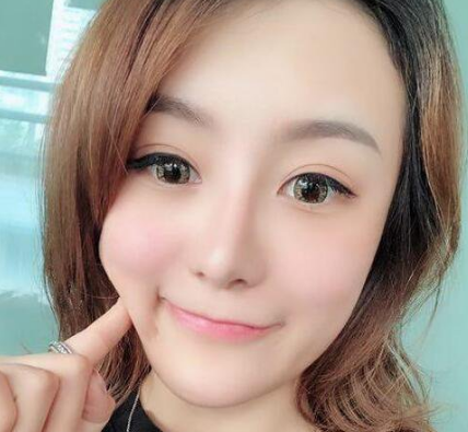 自体脂肪填充术