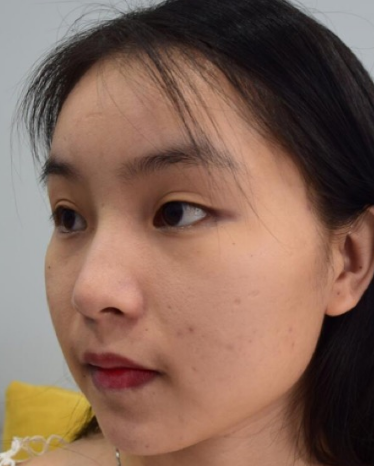 超级微拉美