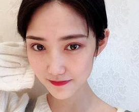 双眼皮手术