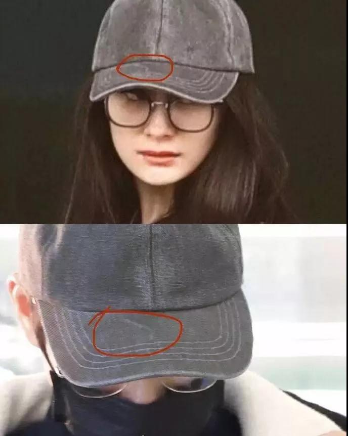 双眼皮手术