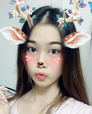 双眼皮手术