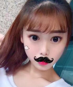 双眼皮手术