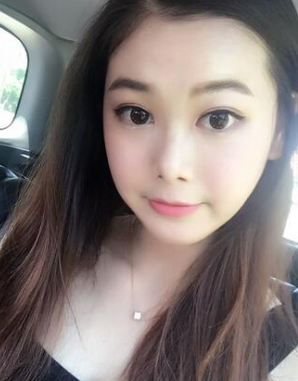 双眼皮手术