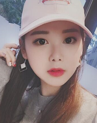 双眼皮手术