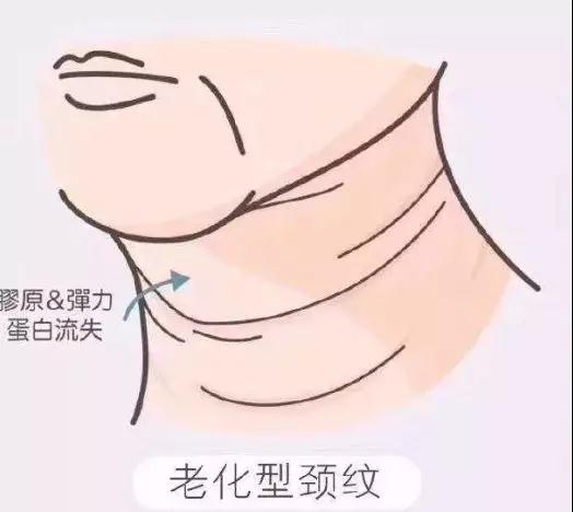面部提升术