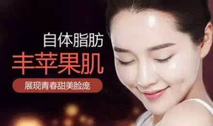 自体脂肪填充术