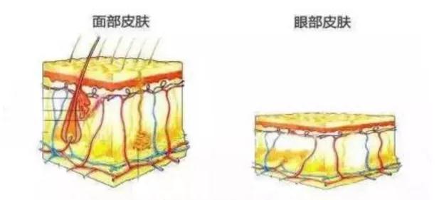 双眼皮手术