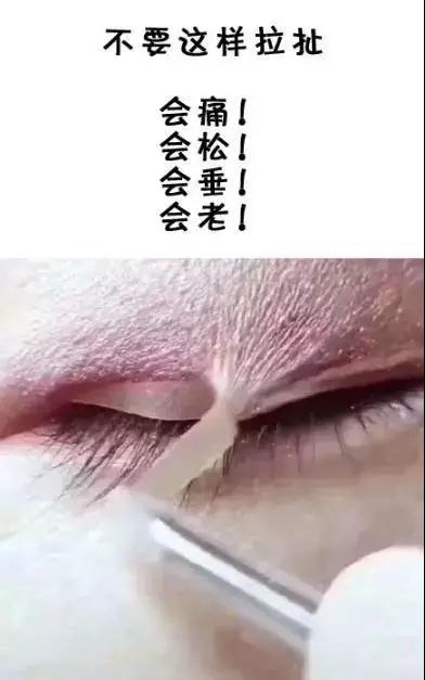 双眼皮手术