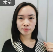 隆鼻手术