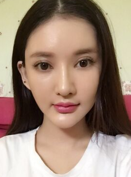 面部提升术