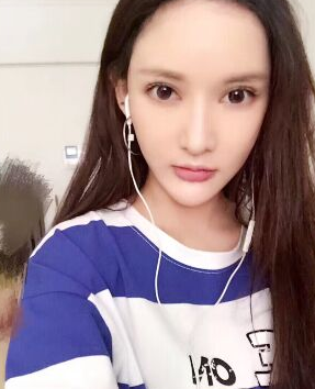 面部提升术