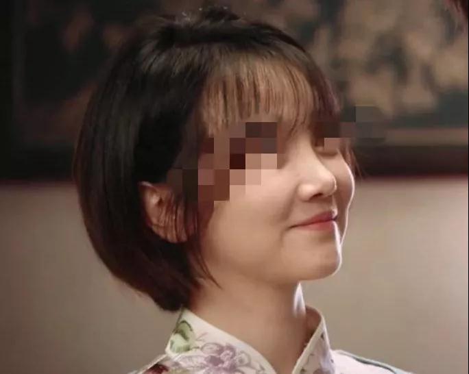 隆鼻手术