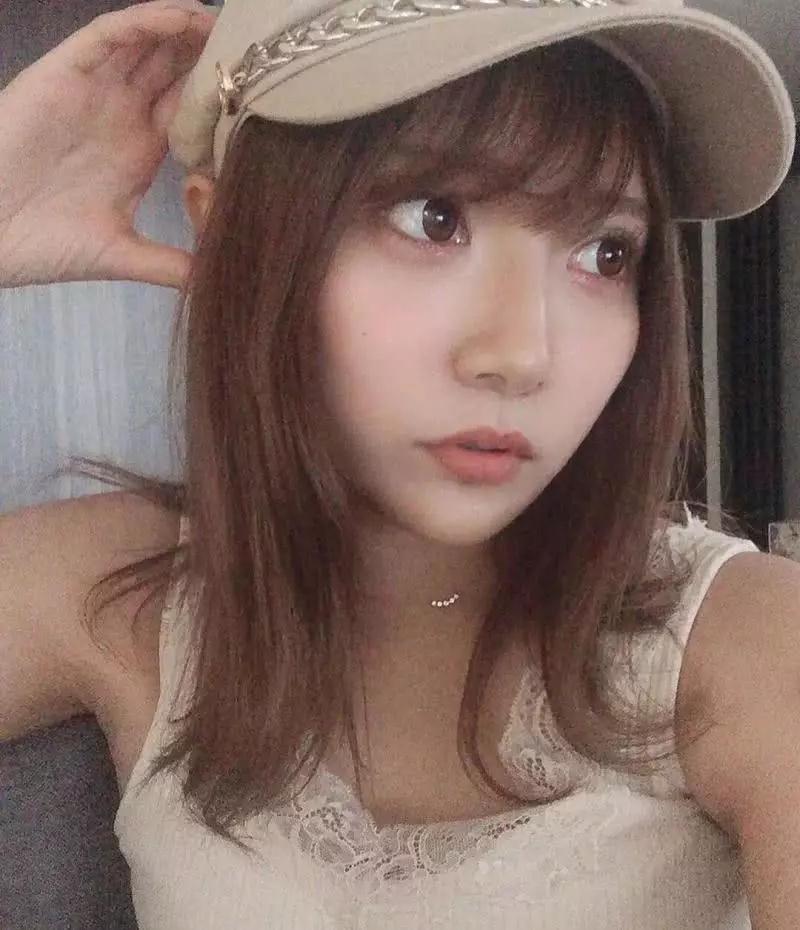 双眼皮手术